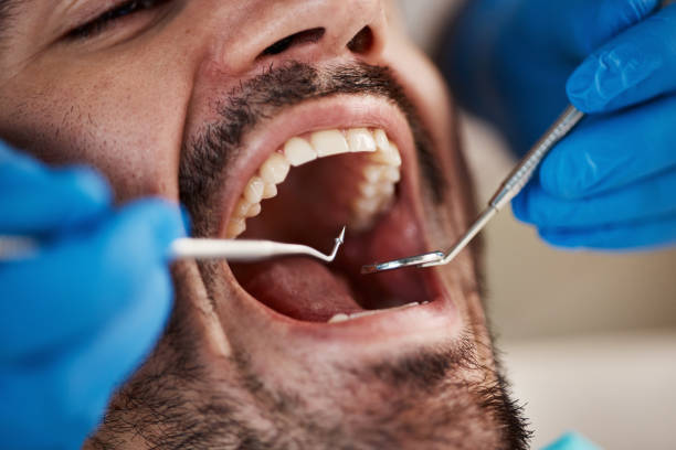 Emergency Dental Services in Ashland, CA